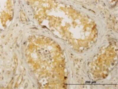 Immunohistochemistry-Paraffin: CDC42BPB Antibody (6G3) [H00009578-M02] - Analysis of monoclonal antibody to CDC42BPB on formalin-fixed paraffin-embedded human testis. Antibody concentration 3 ug/ml.