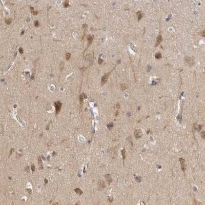 Immunohistochemistry-Paraffin CDC42BPB Antibody