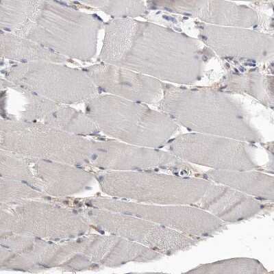 Immunohistochemistry-Paraffin CDC42BPB Antibody