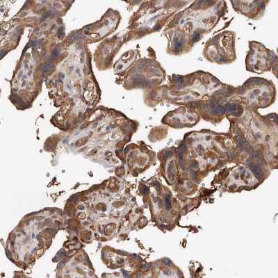 Immunohistochemistry-Paraffin: CDC42BPB Antibody [NBP1-81440] - Staining of human placenta shows moderate to strong cytoplasmic positivity in trophoblastic cells.