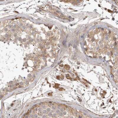 Immunohistochemistry-Paraffin CDC42BPB Antibody