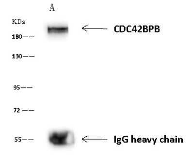 Immunoprecipitation: CDC42BPB Antibody [NBP2-98656] - CDC42BPB was immunoprecipitated using: Lane A: 0.5 mg U251MG Whole Cell Lysate 4 ul anti-CDC42BPB rabbit polyclonal antibody and 60 ug of Immunomagnetic beads Protein A/G.  Primary antibody: Anti-CDC42BPB rabbit polyclonal antibody, at 1:100 dilution. Secondary antibody: Goat Anti-Rabbit IgG (H+L)/HRP at 1/10000 dilution. Developed using the ECL technique. Performed under reducing conditions. Predicted band size: 194 kDa. Observed band size: 194 kDa