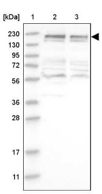 Western Blot: CDC42BPB Antibody [NBP1-81440] - Lane 1: Marker  [kDa] 230, 130, 95, 72, 56, 36, 28, 17, 11.  Lane 2: Human cell line RT-4.  Lane 3: Human cell line U-251MG sp