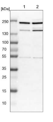 Western Blot: CDC42BPB Antibody [NBP1-81440] - Lane 1: NIH-3T3 cell lysate (Mouse embryonic fibroblast cells). Lane 2: NBT-II cell lysate (Rat Wistar bladder tumor cells).