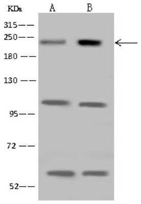 Western Blot: CDC42BPB Antibody [NBP2-98656] - Anti-CDC42BPB rabbit polyclonal antibody at 1:500 dilution. Lane A: Jurkat Whole Cell Lysate Lane B: U 251MG Whole Cell Lysate Lysates/proteins at 30 ug per lane. Secondary Goat Anti-Rabbit IgG (H+L)/HRP at 1/10000 dilution. Developed using the ECL technique. Performed under reducing conditions. Predicted band size: 194 kDa. Observed band size: kDa