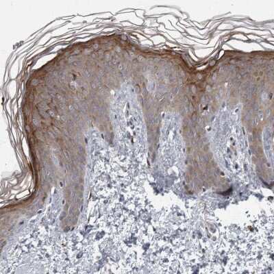 Immunohistochemistry-Paraffin: CDC42BPG Antibody [NBP1-84072] - Staining of human skin shows high expression.