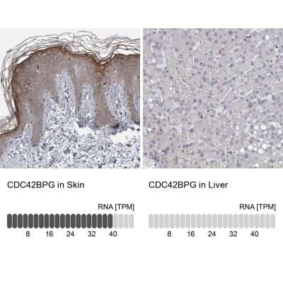 <b>Orthogonal Strategies Validation. </b>Immunohistochemistry-Paraffin: CDC42BPG Antibody [NBP1-84072] - Staining in human skin and liver tissues using anti-CDC42BPG antibody. Corresponding CDC42BPG RNA-seq data are presented for the same tissues.