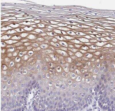 Immunohistochemistry-Paraffin CDC42BPG Antibody