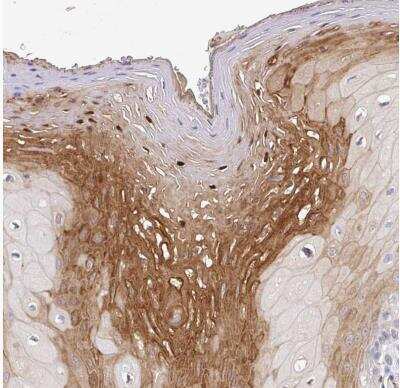 Immunohistochemistry-Paraffin CDC42BPG Antibody