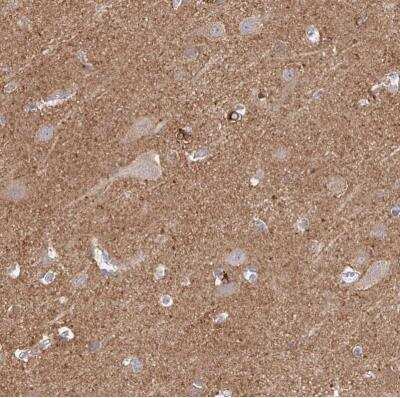 Immunohistochemistry-Paraffin CDC42BPG Antibody