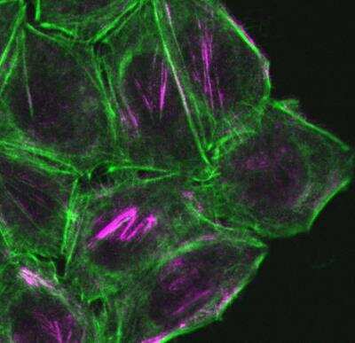 Immunocytochemistry/ Immunofluorescence CDC42EP1 Antibody