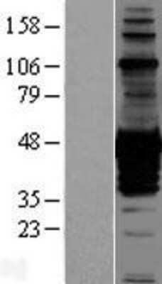 Western Blot: CDC42EP1 Overexpression Lysate (Adult Normal) [NBP2-05411] Left-Empty vector transfected control cell lysate (HEK293 cell lysate); Right -Over-expression Lysate for CDC42EP1.
