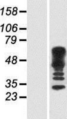 Western Blot: CDC42EP4 Overexpression Lysate (Adult Normal) [NBP2-07490] Left-Empty vector transfected control cell lysate (HEK293 cell lysate); Right -Over-expression Lysate for CDC42EP4.