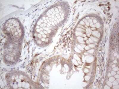 Immunohistochemistry: CDC42SE2 Antibody (1B12) [NBP2-46191] - Analysis of Human colon tissue. (Heat-induced epitope retrieval by 1mM EDTA in 10mM Tris buffer (pH8.5) at 120C for 3 min)