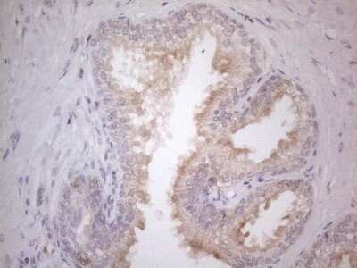 Immunohistochemistry: CDC42SE2 Antibody (1B12) [NBP2-46191] - Analysis of Human prostate tissue. (Heat-induced epitope retrieval by 1mM EDTA in 10mM Tris buffer (pH8.5) at 120C for 3 min)