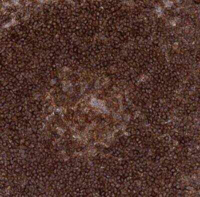 Immunohistochemistry-Paraffin: CDC42SE2 Antibody [NBP1-82131] - Staining of human lymph node shows moderate cytoplasmic positivity in germinal center cells along with strong positivity in non-germinal center cells.