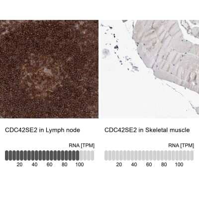 <b>Orthogonal Strategies Validation. </b>Immunohistochemistry-Paraffin: CDC42SE2 Antibody [NBP1-82131] - Staining in human lymph node and skeletal muscle tissues using anti-CDC42SE2 antibody. Corresponding CDC42SE2 RNA-seq data are presented for the same tissues.