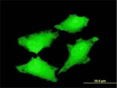 Immunocytochemistry/Immunofluorescence: CDC45L Antibody (3F11-1F3) [H00008318-M01] - Analysis of monoclonal antibody to CDC45L on HeLa cell . Antibody concentration 10 ug/ml.