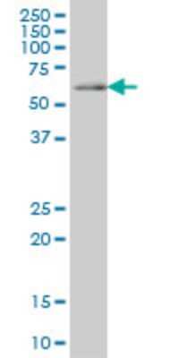 Western Blot: CDC45L Antibody (4C2) [H00008318-M02] - CDC45L monoclonal antibody (M02), clone 4C2 Analysis of CDC45L expression in Jurkat.