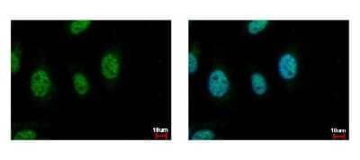 Immunocytochemistry/Immunofluorescence: CDC45L Antibody [NBP1-32772] - HeLa cells were fixed in 4% paraformaldehyde at RT for 15 min. Green: CDC45L protein stained by CDC45L antibody diluted at 1:500. Blue: Hoechst 33342 staining.