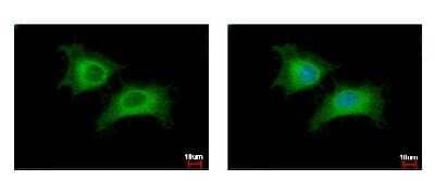 Immunocytochemistry/Immunofluorescence: CDC45L Antibody [NBP2-15834] - CDC45L antibody detects CDC45L protein at cytoplasm by immunofluorescent analysis. Sample: HeLa cells were fixed in 4% paraformaldehyde at RT for 15 min. Green: CDC45L protein stained by CDC45L antibody  diluted at 1:500. Blue: Hoechst 33343 staining.