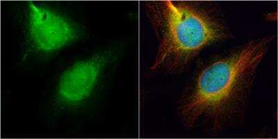 Immunocytochemistry/Immunofluorescence: CDC45L Antibody [NBP2-15834] - CDC45L antibody detects CDC45L protein at cytoplasm and nucleus by immunofluorescent analysis. Sample: HeLa cells were fixed in 4% paraformaldehyde at RT for 15 min.