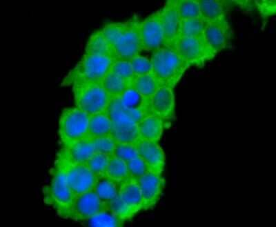 Immunocytochemistry/Immunofluorescence: CDC45L Antibody (JJ091-04) [NBP2-67897] - Staining CDC45 in 293T cells (green). The nuclear counter stain is DAPI (blue). Cells were fixed in paraformaldehyde, permeabilised with 0.25% Triton X100/PBS.