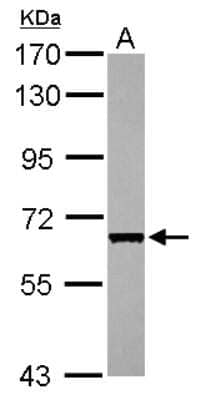 Western Blot: CDC45L Antibody [NBP2-15834] - Sample (30 ug of whole cell lysate) A: HeLa 7. 5% SDS PAGE gel, diluted at 1:1000.