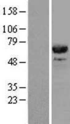 Western Blot: CDC45L Overexpression Lysate (Adult Normal) [NBL1-09012] Left-Empty vector transfected control cell lysate (HEK293 cell lysate); Right -Over-expression Lysate for CDC45L.