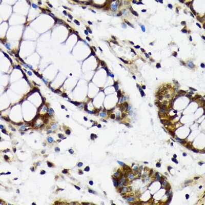 Immunohistochemistry-Paraffin: CDC5L Antibody (1D10W9) [NBP3-16816] - Immunohistochemistry of paraffin-embedded human colon using CDC5L Rabbit mAb (NBP3-16816) at dilution of 1:100 (40x lens).Perform microwave antigen retrieval with 10 mM Tris/EDTA buffer pH 9.0 before commencing with IHC staining protocol.