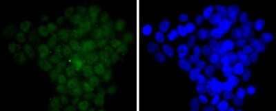 Immunocytochemistry/Immunofluorescence: CDC5L Antibody (JJ091-05) [NBP2-67901] - Staining CDC5L in 293T cells (green). The nuclear counter stain is DAPI (blue). Cells were fixed in paraformaldehyde, permeabilised with 0.25% Triton X100/PBS.