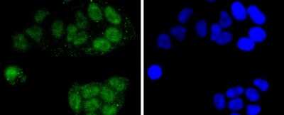 Immunocytochemistry/Immunofluorescence: CDC5L Antibody (JJ091-05) [NBP2-67901] - Staining CDC5L in Hela cells (green). The nuclear counter stain is DAPI (blue). Cells were fixed in paraformaldehyde, permeabilised with 0.25% Triton X100/PBS.