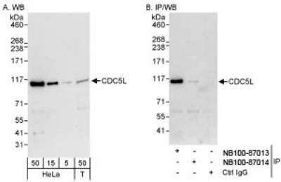 Western Blot: CDC5L Antibody [NB100-87014] - Detection of Human CDC5L on HeLa whole cell lysate using NB100-87014. CDC5L  was also immunoprecipitated by rabbit anti-CDC5L antibody NB100-87013.