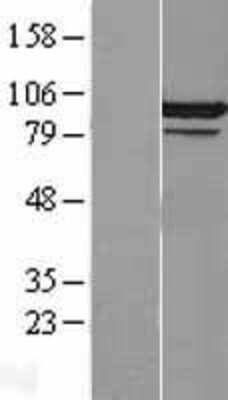 Western Blot: CDC5L Overexpression Lysate (Adult Normal) [NBL1-09013] Left-Empty vector transfected control cell lysate (HEK293 cell lysate); Right -Over-expression Lysate for CDC5L.