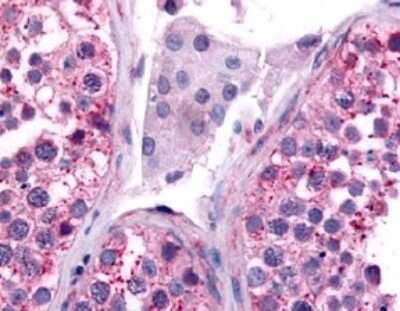 Immunohistochemistry-Paraffin: CDC7 Antibody [NLS7979] - Analysis of anti-CDC7 antibody with testis at 5.2 ug/ml.