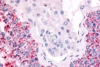 Immunohistochemistry-Paraffin: CDC7 Antibody [NLS7980] - Anti-CDC7 antibody IHC of human testis. Immunohistochemistry of formalin-fixed, paraffin-embedded tissue after heat-induced antigen retrieval.