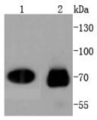 Western Blot: CDC7 Antibody (SY21-01) [NBP2-67421] - Analysis of CDC7 Kinase on different lysates using anti-CDC7 antibody at 1:1000 dilution. Lane 1 (positive control): Jurkat cells lysate. Lane 2: HeLa cell lysate.