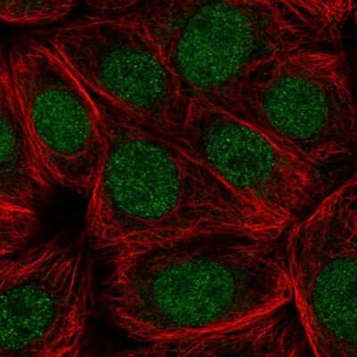 Immunocytochemistry/Immunofluorescence: CDC73/HRPT2 Antibody [NBP2-55257] - Staining of human cell line MCF7 shows localization to nucleus. Antibody staining is shown in green.