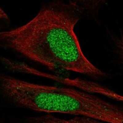 Immunocytochemistry/Immunofluorescence: CDC73/HRPT2 Antibody [NBP3-17817] - Staining of human cell line U-2 OS shows localization to nucleoplasm.