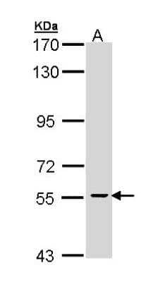 Western Blot: CDC73/HRPT2 Antibody [NBP1-32972] - Sample (30 ug of whole cell lysate) A: Molt-4 7. 5% SDS PAGE; antibody diluted at 1:1000.