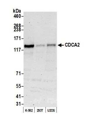 Western Blot: CDCA2 Antibody [NBP2-78704] - Whole cell lysate (50 ug) from K-562, HEK293T, and U2OS cells prepared using NETN lysis buffer. Using this antibody for WB at 1:1000. Detection: Chemiluminescence with an exposure time of 75 seconds.