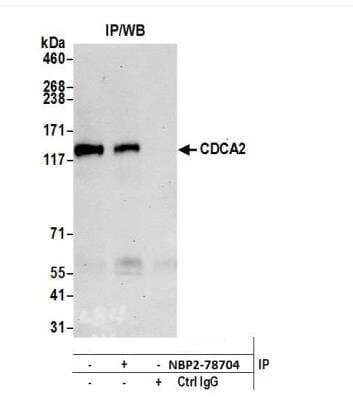 Immunoprecipitation: CDCA2 Antibody [NBP2-78704] - Detection of human CDCA2 by western blot of immunoprecipitates. Samples: Whole cell lysate (1.0 mg per IP reaction; 20% of IP loaded) from K-562 cells prepared using NETN lysis buffer. Antibodies: This anti-body was used for IP at 100 ul per reaction. For blotting immunoprecipitated CDCA2, This antibody was used at 1:1000. Detection: Chemiluminescence with an exposure time of 30 seconds.