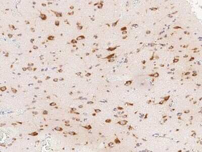 Immunohistochemistry-Paraffin: CDCA3 Antibody [NBP2-98988] - Immunochemical staining of human CDCA3 in human brain with rabbit polyclonal antibody at 1:1000 dilution, formalin-fixed paraffin embedded sections.