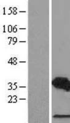 Western Blot: CDCA3 Overexpression Lysate (Adult Normal) [NBL1-09016] Left-Empty vector transfected control cell lysate (HEK293 cell lysate); Right -Over-expression Lysate for CDCA3.