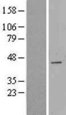 Western Blot: CDCA7 Overexpression Lysate (Adult Normal) [NBL1-09020] Left-Empty vector transfected control cell lysate (HEK293 cell lysate); Right -Over-expression Lysate for CDCA7.
