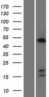 Western Blot: CDCA7 Overexpression Lysate (Adult Normal) [NBP2-09927] Left-Empty vector transfected control cell lysate (HEK293 cell lysate); Right -Over-expression Lysate for CDCA7.