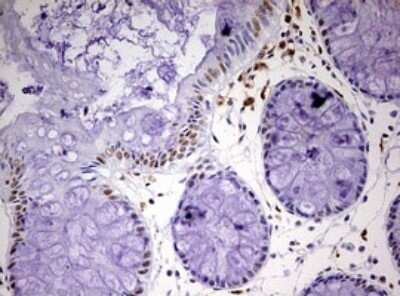 Immunohistochemistry: CDCA7L Antibody (OTI3B5) - Azide and BSA Free [NBP2-72009] - Analysis of Human colon tissue. (Heat-induced epitope retrieval by 10mM citric buffer, pH6.0, 120C for 3min)