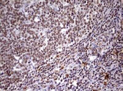 Immunohistochemistry: CDCA7L Antibody (OTI3B5) - Azide and BSA Free [NBP2-72009] - Analysis of Human tonsil tissue. (Heat-induced epitope retrieval by 10mM citric buffer, pH6.0, 120C for 3min)