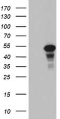 Western Blot: CDCA7L Antibody (OTI3B5) - Azide and BSA Free [NBP2-72009] - Analysis of HEK293T cells were transfected with the pCMV6-ENTRY control (Left lane) or pCMV6-ENTRY CDCA7L.