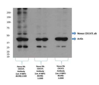 Western Blot: CDCA7L Antibody (OTI3B5) - Azide and BSA Free [NBP2-72009] - Detection of CDCA7L by western blot. Samples: Whole cell lysate from prostate cancer; 40 ug. Antibodies:CDCA7L Antibody [NBP2-46198] at dilutions 1:500, 1:1000, 1:2000. Detection: Chemiluminescence with exposure of 5 seconds. Image from verified customer